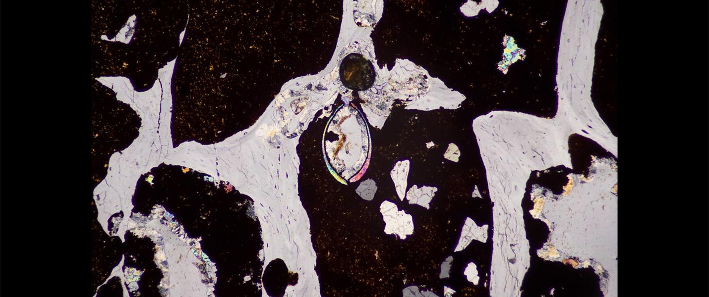 micrograph of fossil bone